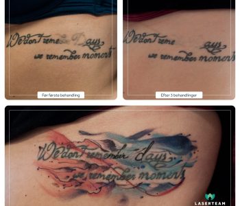 Blegning før coverup