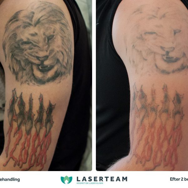 Tattoo: Løve skulder